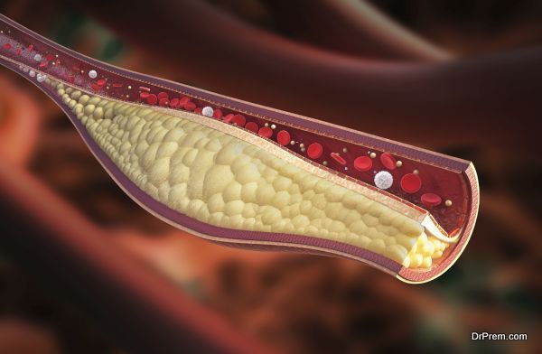 cholesterol under control